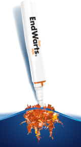 csm_Endwarts_PEN_wart